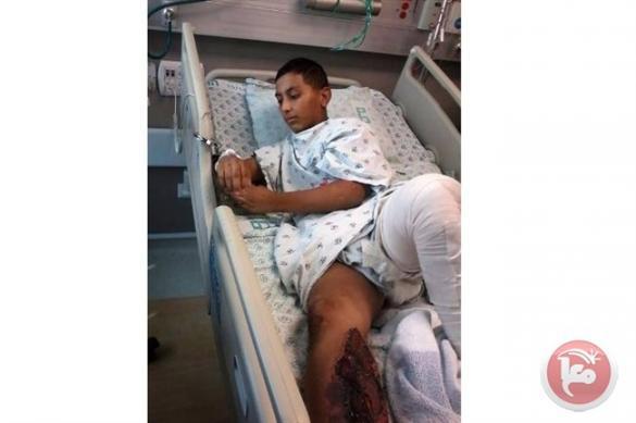 الطفل الاسير عيسى المعطي مهدد ببتر قدمه اليمنى بعد اصابته برصاص الاحتلال