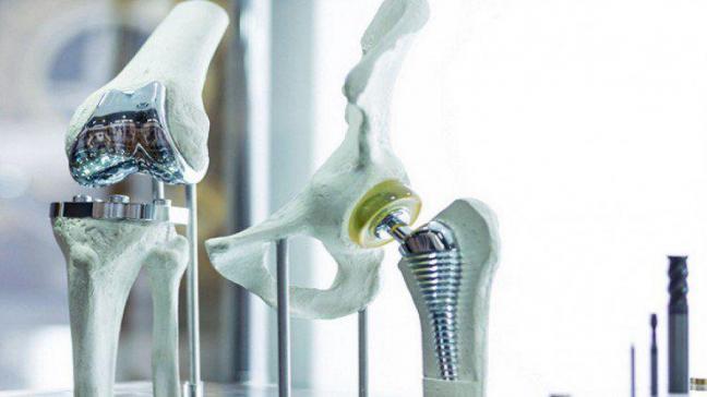 وداعا للتيتانيوم في جراحة العظام