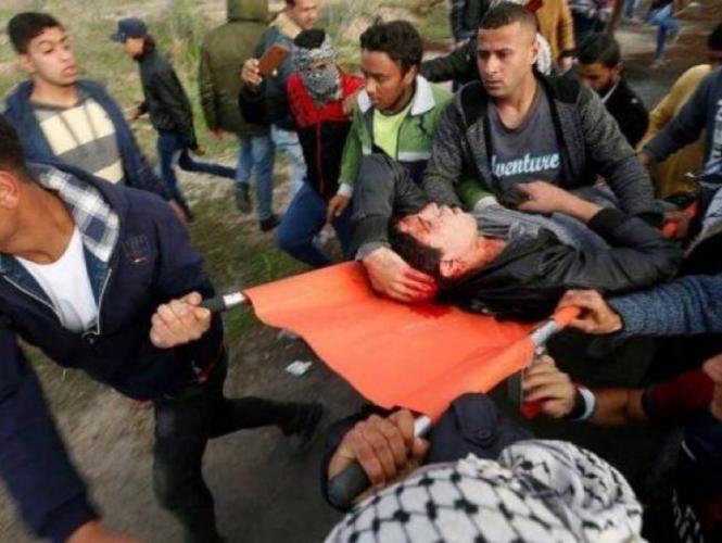 الثالث خلال اليوم- شهيد متأثراً بإصابته بغزة